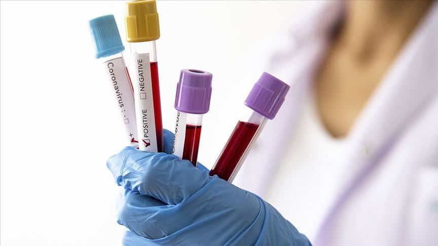 TK – 36 novozaraženih osoba koronavirusom, četiri smrtna slučaja